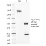 SDS-PAGE - Anti-Phosphotyrosine Antibody [PY20] (A250858) - Antibodies.com
