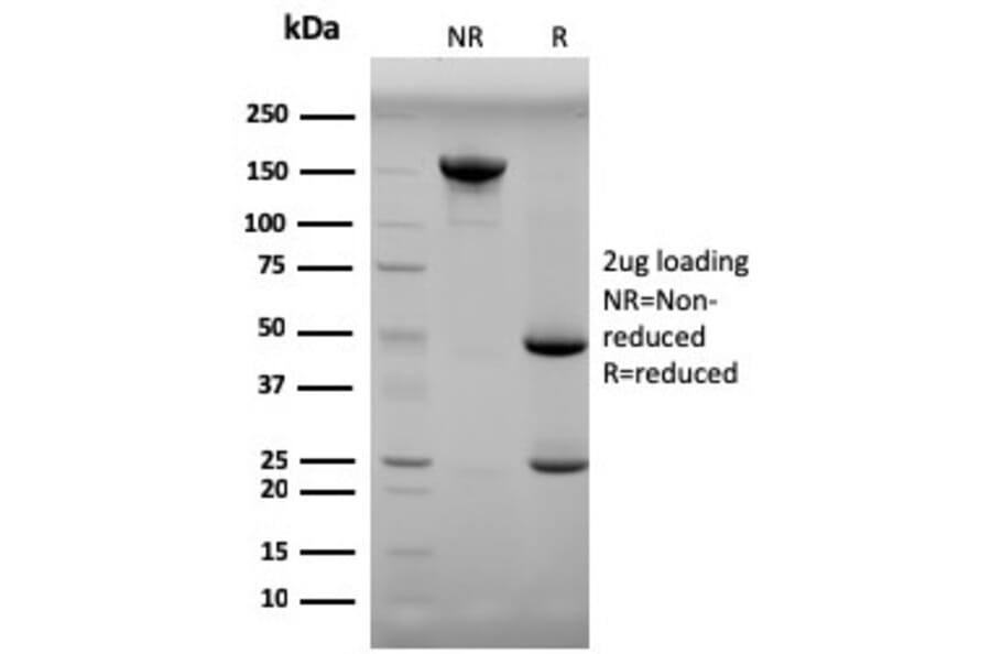 SDS-PAGE - Anti-Progesterone Antibody [6-5E-3F] (A250858) - Antibodies.com