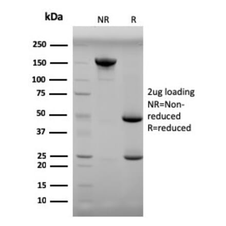 SDS-PAGE - Anti-Progesterone Antibody [6-5E-3F] (A250858) - Antibodies.com