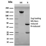 SDS-PAGE - Anti-Progesterone Antibody [6-5E-3F] (A250858) - Antibodies.com
