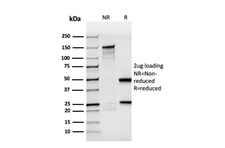 SDS-PAGE - Anti-BrdU Antibody [rBRD494] (A250859) - Antibodies.com