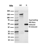 SDS-PAGE - Anti-BrdU Antibody [rBRD494] (A250859) - Antibodies.com