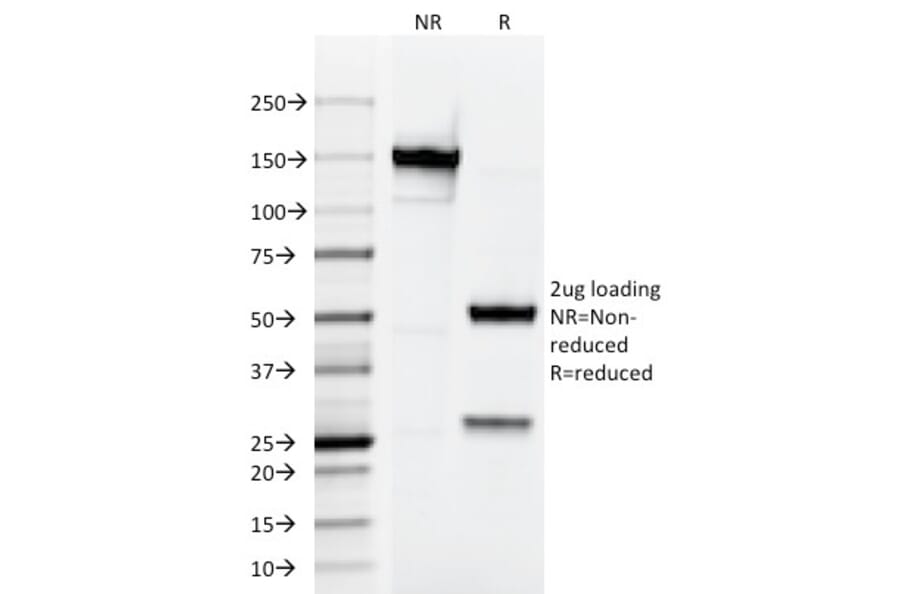 SDS-PAGE - Anti-Testosterone Antibody [4E1G2] (A250862) - Antibodies.com