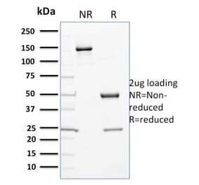 SDS-PAGE - Anti-Cytochrome P450 3A1 Antibody [P6] (A250866) - Antibodies.com