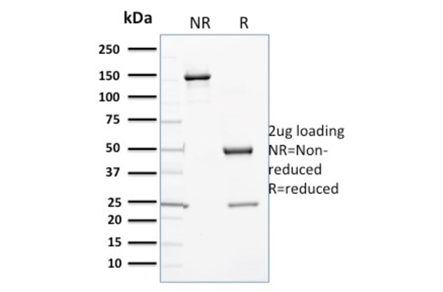 SDS-PAGE - Anti-Cytochrome P450 3A1 Antibody [P6] (A250866) - Antibodies.com