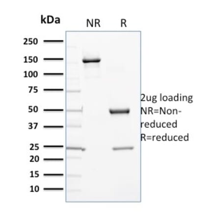 SDS-PAGE - Anti-Cytochrome P450 3A1 Antibody [P6] (A250866) - Antibodies.com