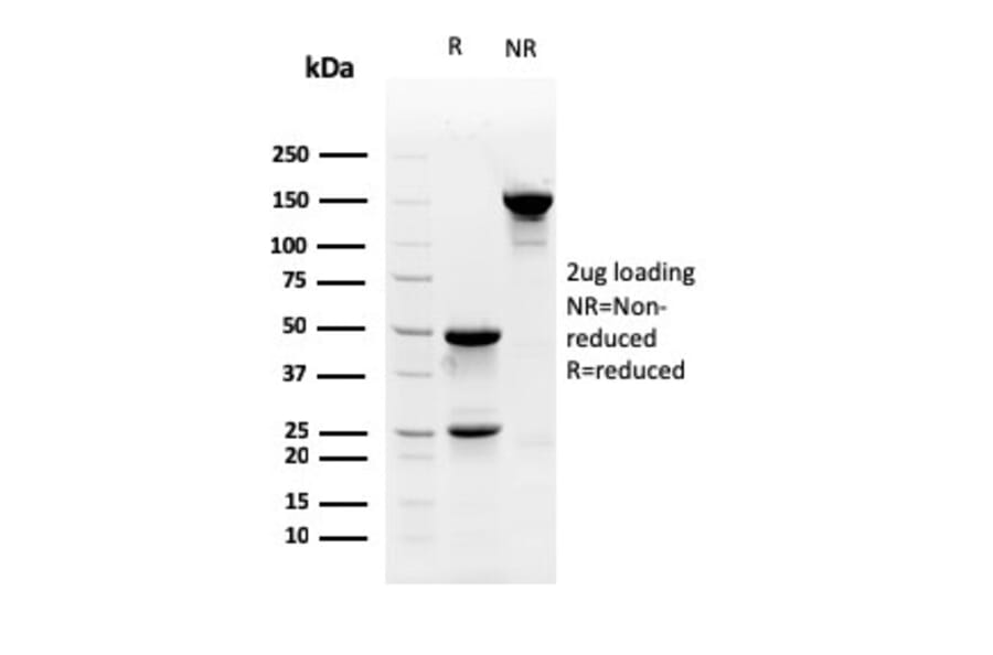 SDS-PAGE - Anti-Myofibroblast Antibody [PR 2D3] (A250867) - Antibodies.com