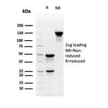 SDS-PAGE - Anti-Myofibroblast Antibody [PR 2D3] (A250867) - Antibodies.com