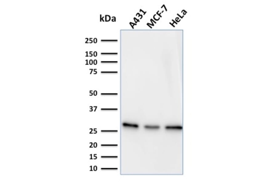 Western Blot - Anti-Myofibroblast Antibody [PR 2D3] (A250868) - Antibodies.com