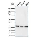 Western Blot - Anti-Myofibroblast Antibody [PR 2D3] (A250868) - Antibodies.com