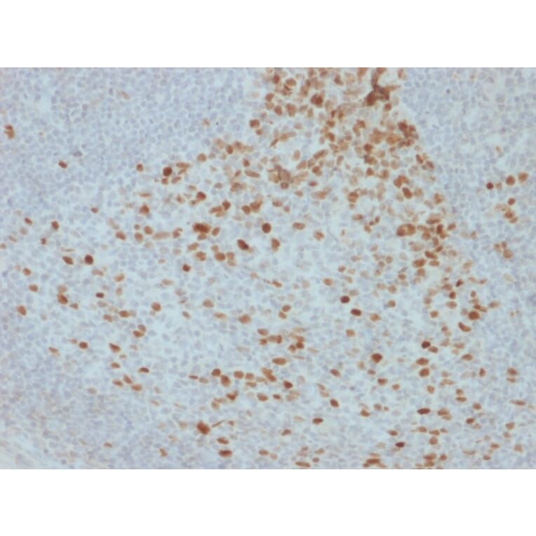 Immunohistochemistry - Anti-Proliferation Antibody [JC1] (A250870) - Antibodies.com