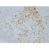 Immunohistochemistry - Anti-Proliferation Antibody [JC1] (A250870) - Antibodies.com