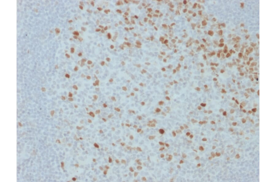Immunohistochemistry - Anti-Proliferation Antibody [JC1] (A250869) - Antibodies.com