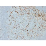 Immunohistochemistry - Anti-Proliferation Antibody [JC1] (A250869) - Antibodies.com