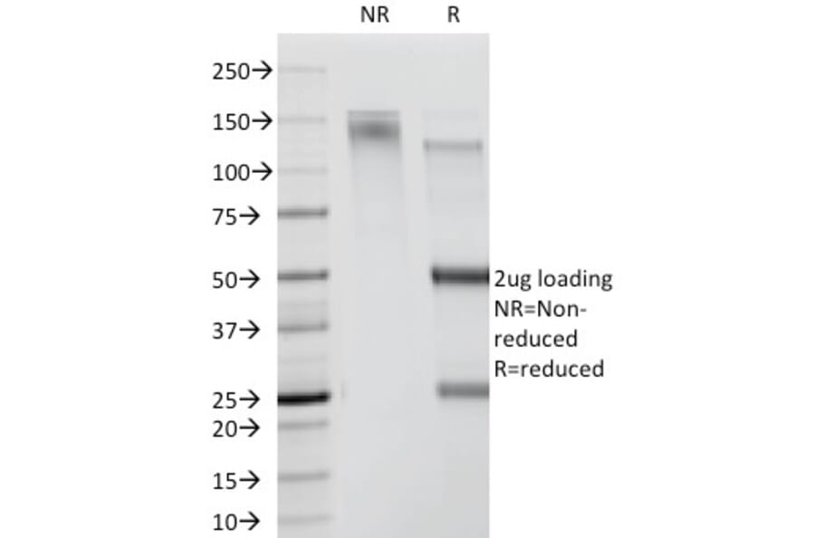 SDS-PAGE - Anti-CDw78 Antibody [DF1588] (A250870) - Antibodies.com