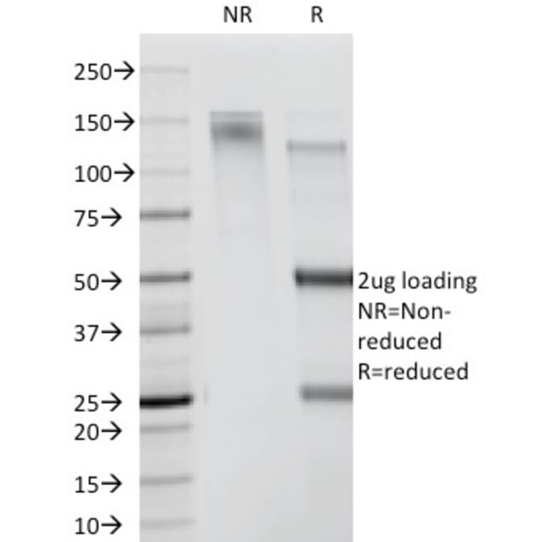 SDS-PAGE - Anti-CDw78 Antibody [DF1588] (A250870) - Antibodies.com