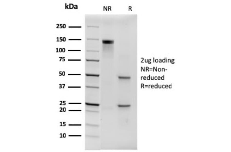SDS-PAGE - Anti-His Tag Antibody [6HIS/3550] (A250871) - Antibodies.com