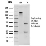 SDS-PAGE - Anti-His Tag Antibody [6HIS/3550] (A250871) - Antibodies.com