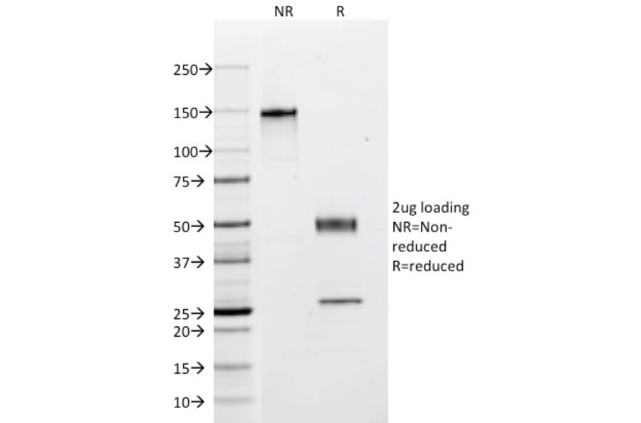 SDS-PAGE - Anti-pan Cytokeratin Antibody [C11] (A250873) - Antibodies.com
