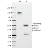 SDS-PAGE - Anti-pan Cytokeratin Antibody [C11] (A250873) - Antibodies.com
