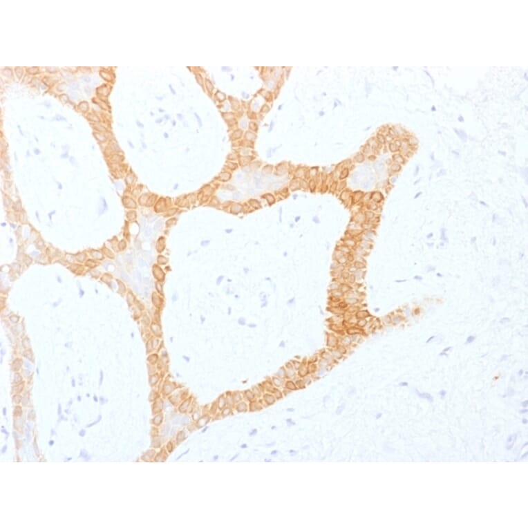 Immunohistochemistry - Anti-Cytokeratin 5 + 8 Antibody [C-50] (A250873) - Antibodies.com