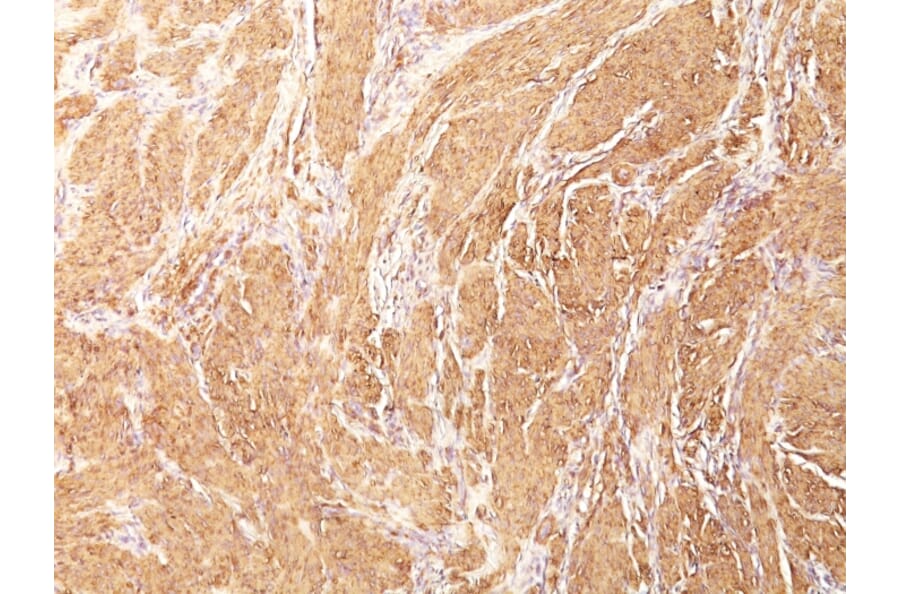 Immunohistochemistry - Anti-Muscle Actin Antibody [HHF35] (A250876) - Antibodies.com