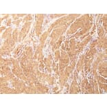 Immunohistochemistry - Anti-Muscle Actin Antibody [HHF35] (A250876) - Antibodies.com