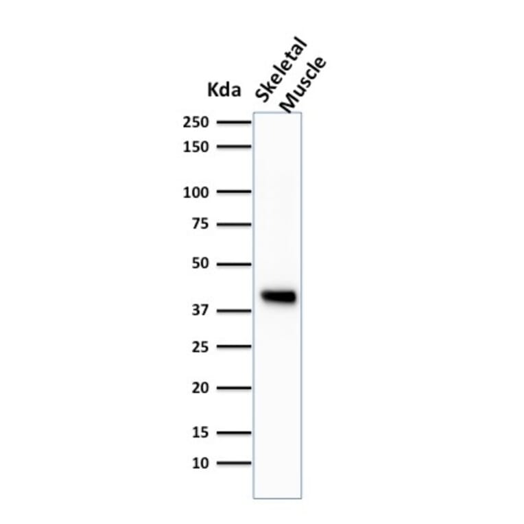 Western Blot - Anti-Muscle Actin Antibody [HHF35] (A250877) - Antibodies.com