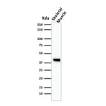 Western Blot - Anti-Muscle Actin Antibody [HHF35] (A250877) - Antibodies.com