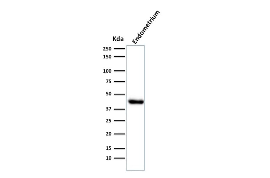 Western Blot - Anti-Muscle Actin Antibody [HHF35] (A250877) - Antibodies.com