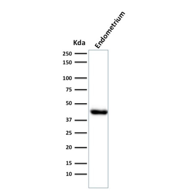 Western Blot - Anti-Muscle Actin Antibody [HHF35] (A250877) - Antibodies.com