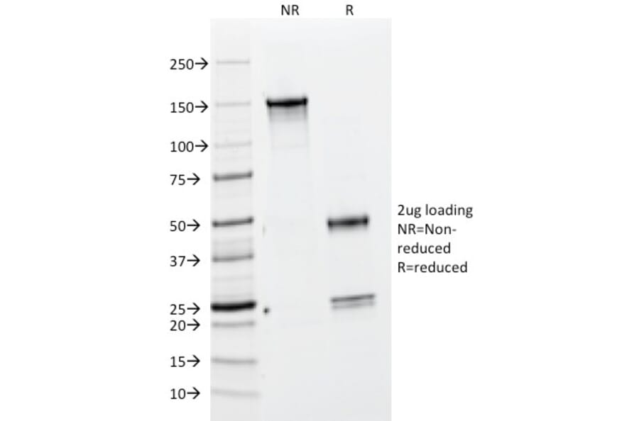 SDS-PAGE - Anti-BrdU Antibody [BRD469] (A250878) - Antibodies.com