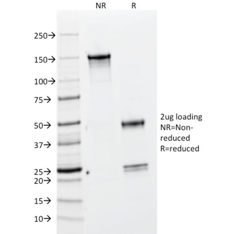 SDS-PAGE - Anti-BrdU Antibody [BRD469] (A250878) - Antibodies.com