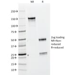 SDS-PAGE - Anti-BrdU Antibody [BRD469] (A250878) - Antibodies.com