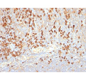 Immunohistochemistry - Anti-Plasma Cell Antibody [LIV3G11] (A250878) - Antibodies.com