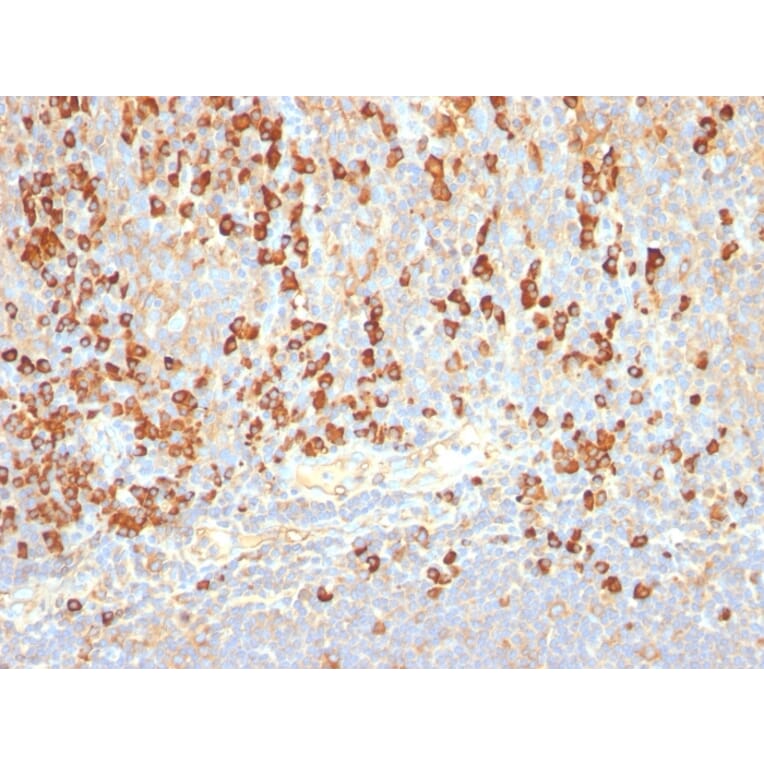 Immunohistochemistry - Anti-Plasma Cell Antibody [LIV3G11] (A250878) - Antibodies.com