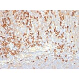 Immunohistochemistry - Anti-Plasma Cell Antibody [LIV3G11] (A250878) - Antibodies.com
