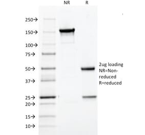 SDS-PAGE - Anti-HPV16 L1 Antibody [CAMVIR-1] (A250881) - Antibodies.com