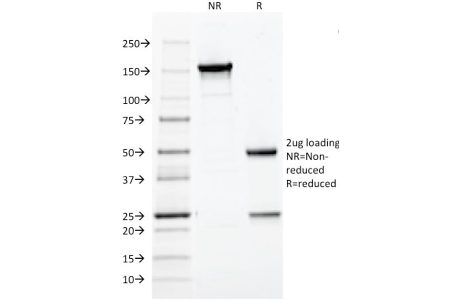 SDS-PAGE - Anti-HPV16 L1 Antibody [CAMVIR-1] (A250881) - Antibodies.com