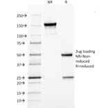 SDS-PAGE - Anti-HPV16 L1 Antibody [CAMVIR-1] (A250881) - Antibodies.com