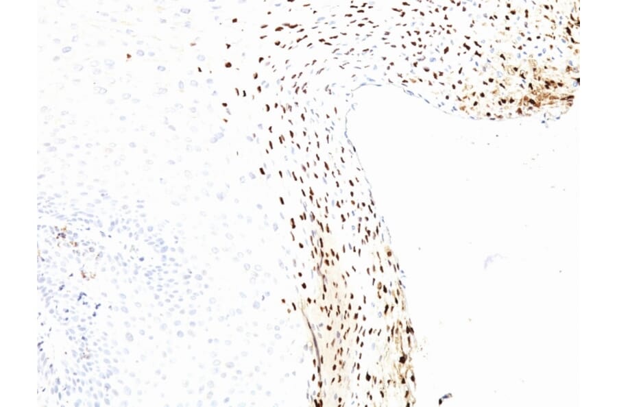 Immunohistochemistry - Anti-HPV16 L1 Antibody [CAMVIR-1] (A250880) - Antibodies.com