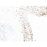 Immunohistochemistry - Anti-HPV16 L1 Antibody [CAMVIR-1] (A250880) - Antibodies.com