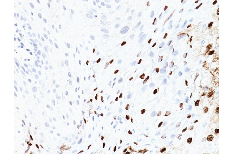 Immunohistochemistry - Anti-HPV16 L1 Antibody [SPM405] (A250881) - Antibodies.com
