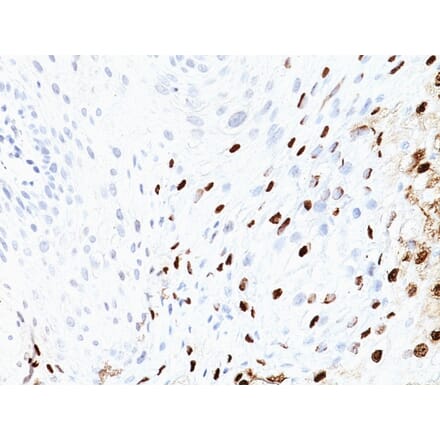 Immunohistochemistry - Anti-HPV16 L1 Antibody [SPM405] (A250881) - Antibodies.com