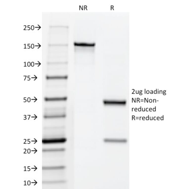 SDS-PAGE - Anti-HCG Holo Antibody [HCGab/52] (A250883) - Antibodies.com