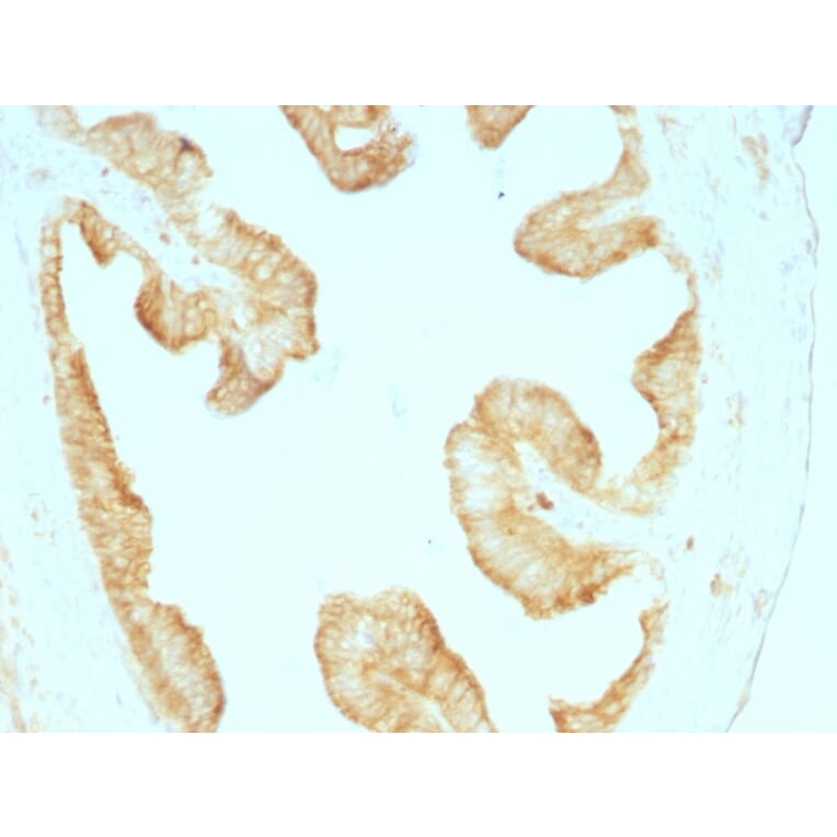 Immunohistochemistry - Anti-pan Cytokeratin Antibody [KRT/457] (A250884) - Antibodies.com