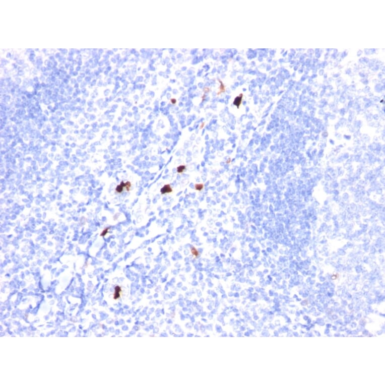 Immunohistochemistry - Anti-Macrophage + Granulocyte Antibody [BM-1] (A250884) - Antibodies.com