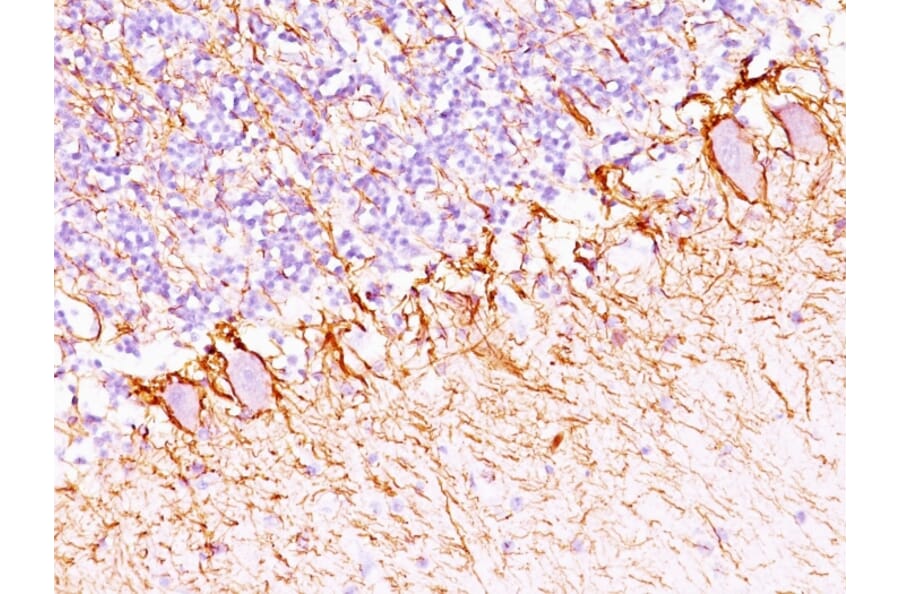 Immunohistochemistry - Anti-Neurofilament Heavy Polypeptide Antibody [NF421 + NFL/736] (A250886) - Antibodies.com