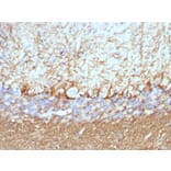 Immunohistochemistry - Anti-Neurofilament Heavy Polypeptide Antibody [NF421 + NFL/736] (A250886) - Antibodies.com