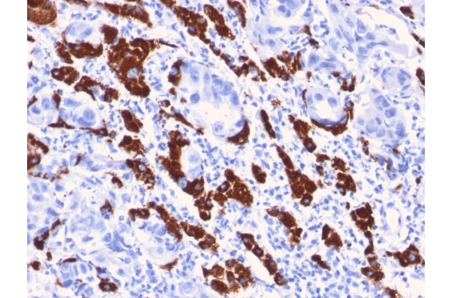 Immunohistochemistry - Anti-Hepatocyte Specific Antigen Antibody [OCH1E5] (A250888) - Antibodies.com